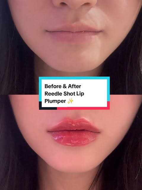 نافخ شفايف VT lip expert