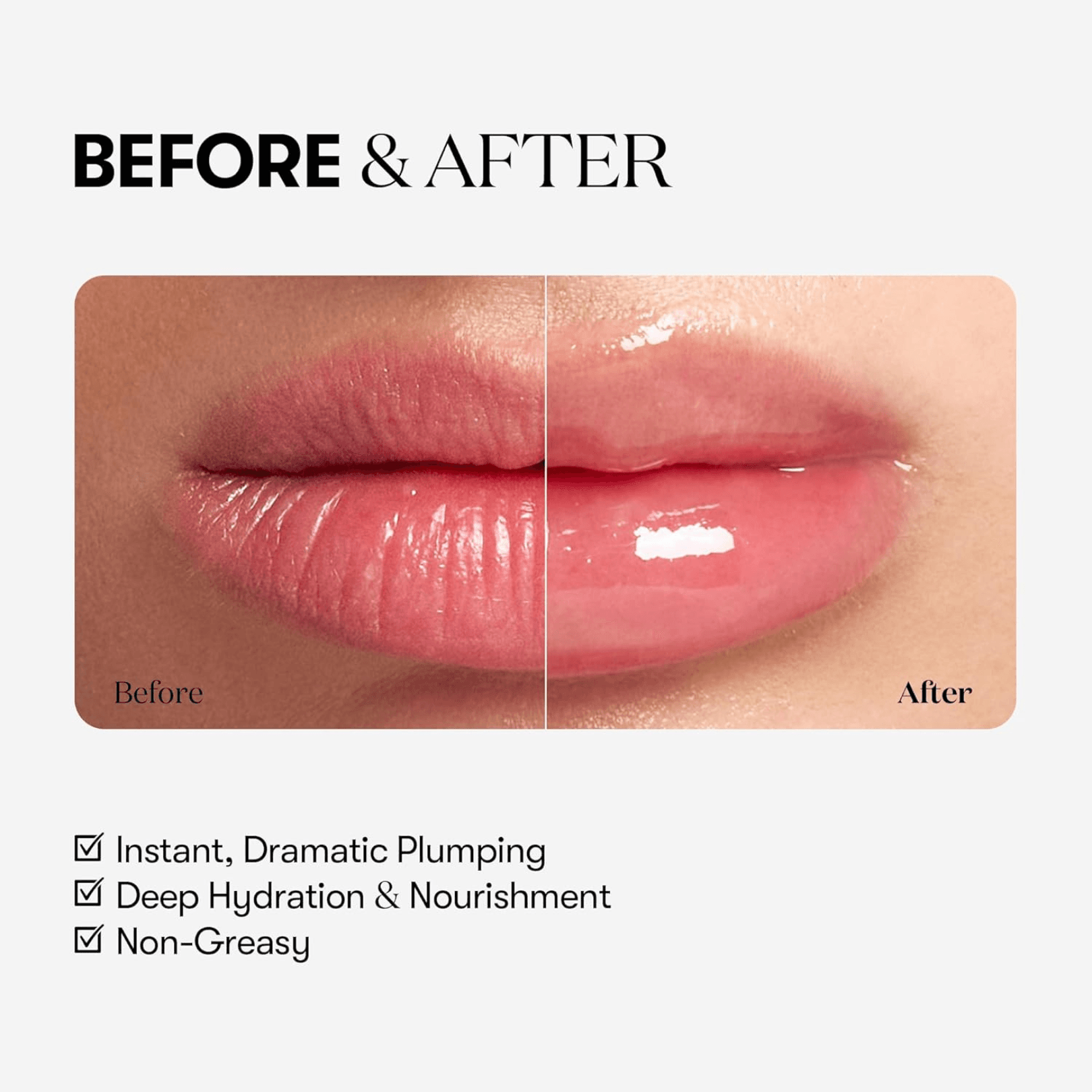 نافخ شفايف VT lip expert
