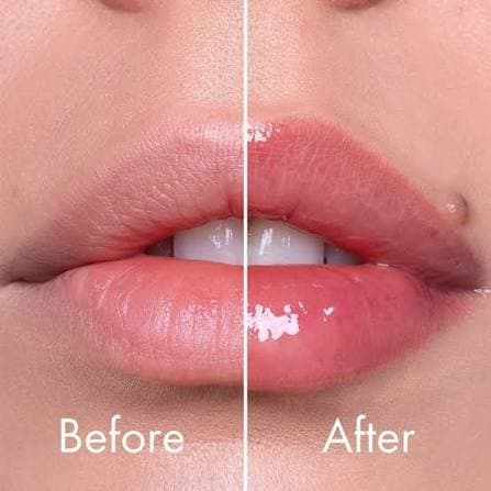 نافخ شفايف VT lip expert
